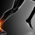 Achilles Tendinopathy